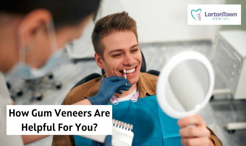How Gum Veneers Are Helpful For You