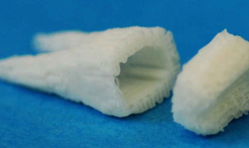 Stem Cell Dental Implants