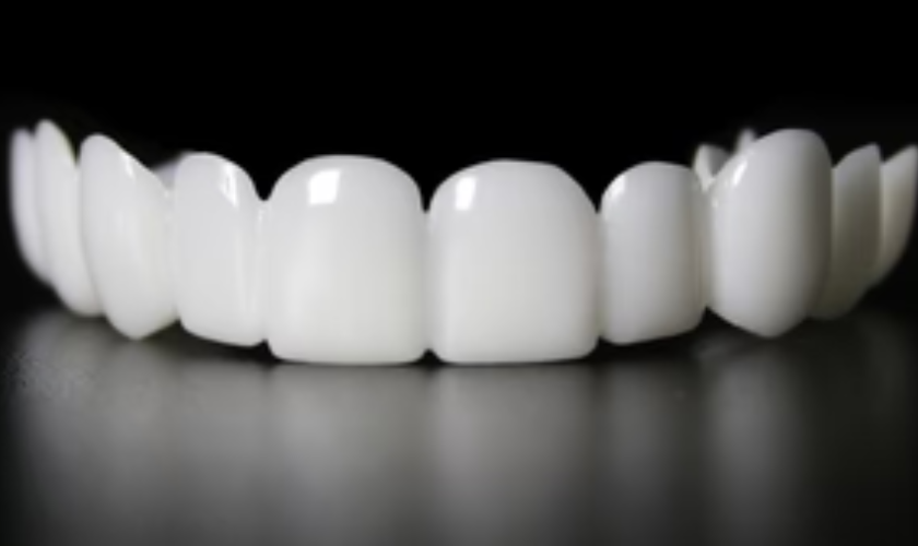 What do you do if you are unhappy with veneers