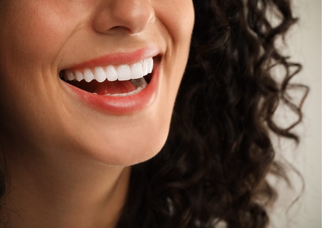 Close-up of a bright, even smile enhanced with dental veneers, illustrating the aesthetic results patients consider when evaluating veneers cost.