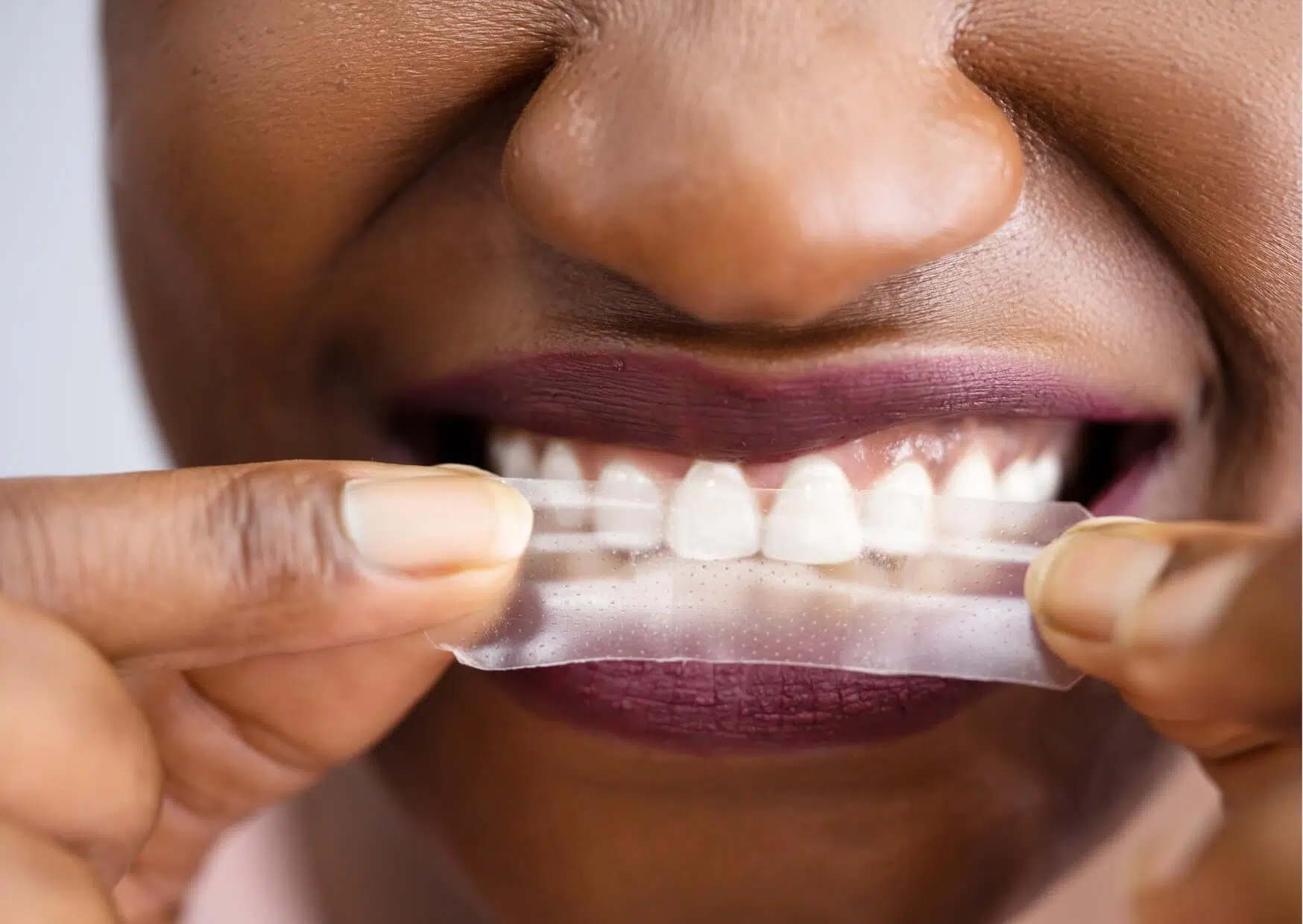 Person applying whitening strips to their teeth at home, illustrating how teeth whitening strips effectiveness depends on proper use and treatment duration.