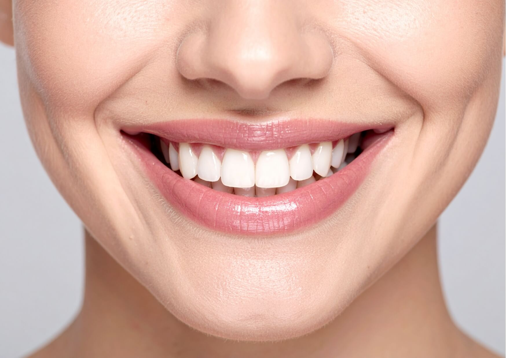 Close-up of a healthy smile with porcelain veneers, illustrating the long-lasting appearance and durability of porcelain veneers.