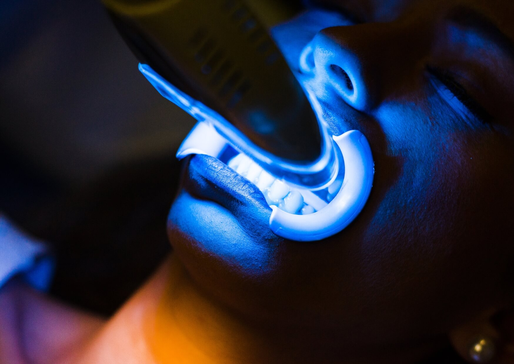 Patient undergoing professional in-office teeth whitening treatment with an LED light as one of several teeth whitening options.