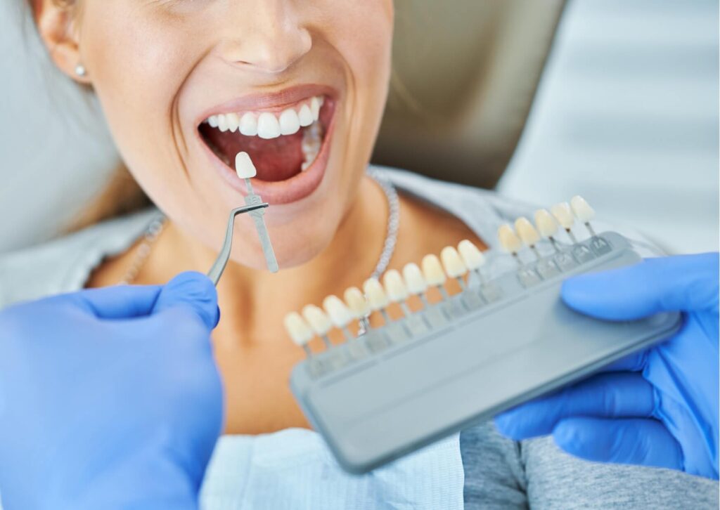 Dentist helping a patient compare teeth whitening options using a shade guide before cosmetic whitening treatment.